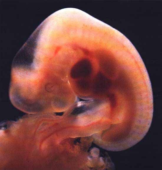 Плод крупнее на неделю. 2-3 Недели беременности фото эмбриона. Зародыш на 2 неделе беременности. Зародыш на 4 неделе беременности. Плод 3-4 недели беременности.