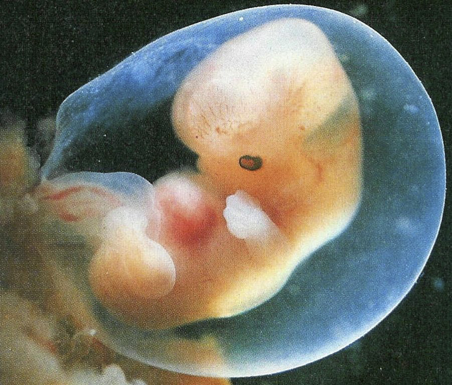 Эмбрион на какой неделе. Эмбрион на 7 неделе беременности. Эмбрион на 4-5 неделе беременности. Беременность 7 недель выглядит эмбрион. Зародыш на 7 неделе беременности.