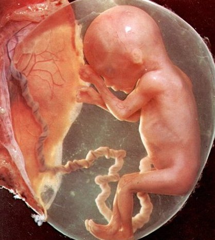 foetus 4 mois grossesse
