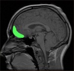 cortex orbitofrontal